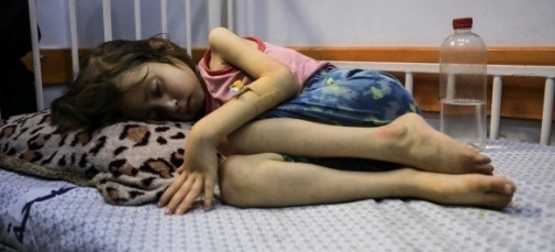 Un enfant souffrant de malnutrition est allongé sur un lit à l'hôpital Patient Society de la ville de Gaza.
